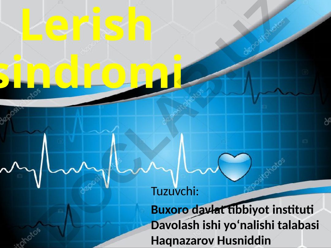 Lerish sindromi