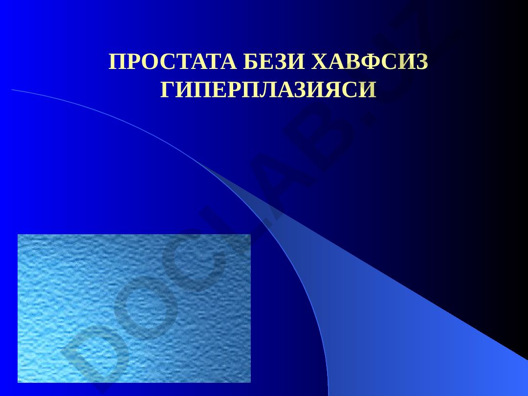 Простата бези хавфсиз гиперплазияси