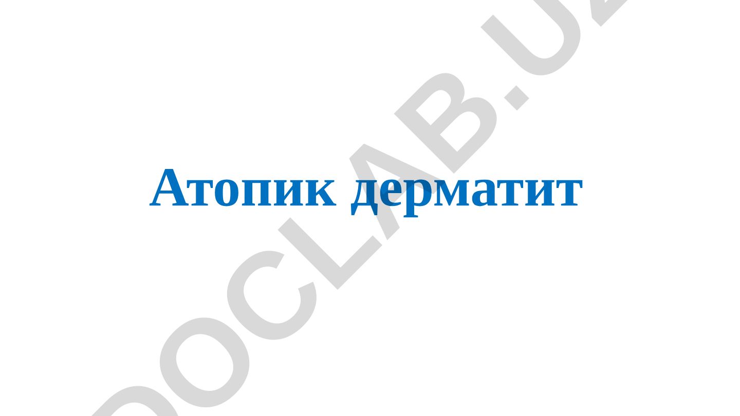 Атопик дерматит: распространенность, особенности и клинические проявления