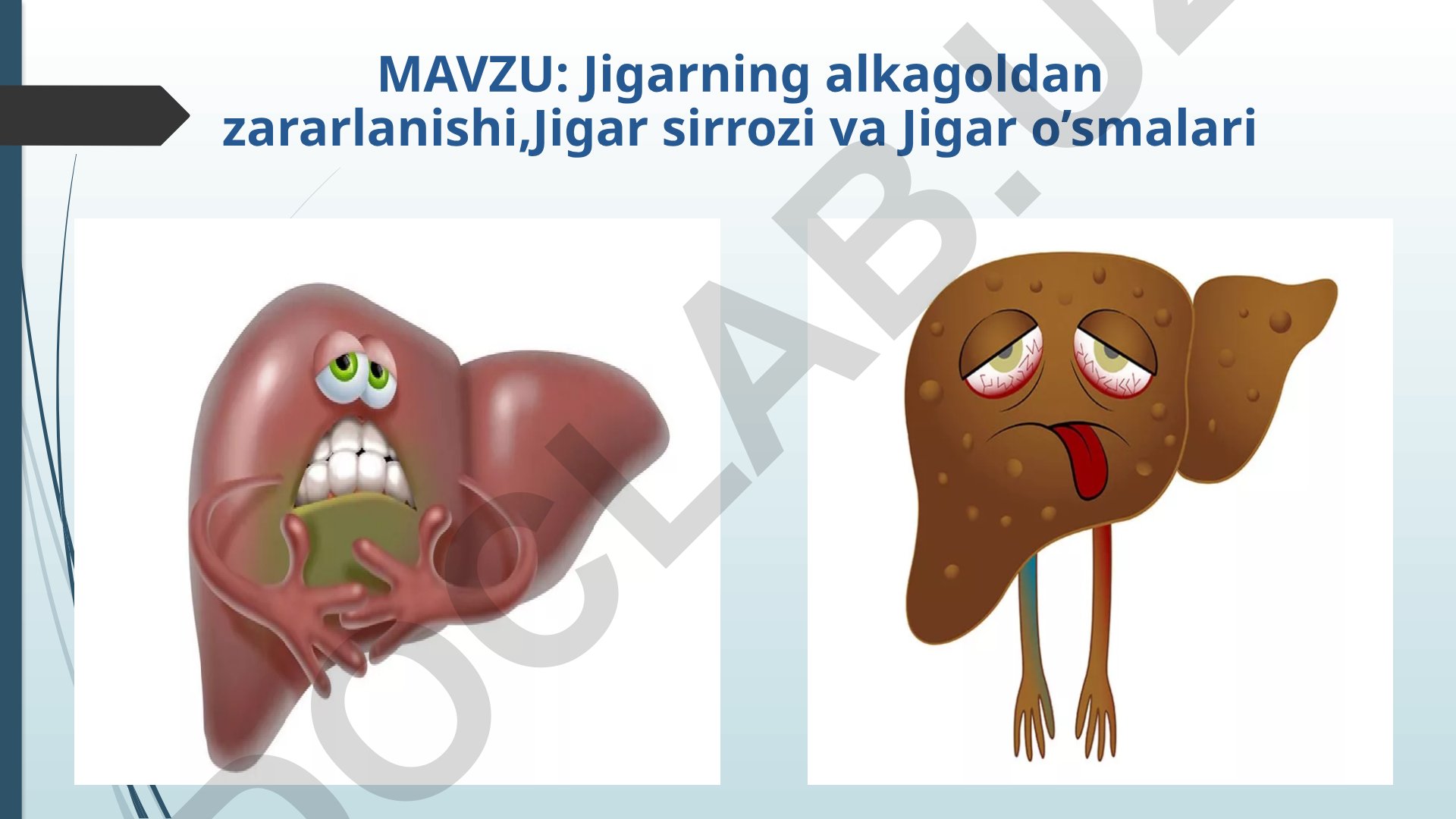 Jigarning alkagoldan zararlanishi, Jigar sirrozi va Jigar o’smalari
