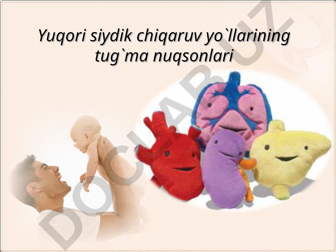 Yuqori siydik chiqaruv yo'llarining tug'ma nuqsonlari