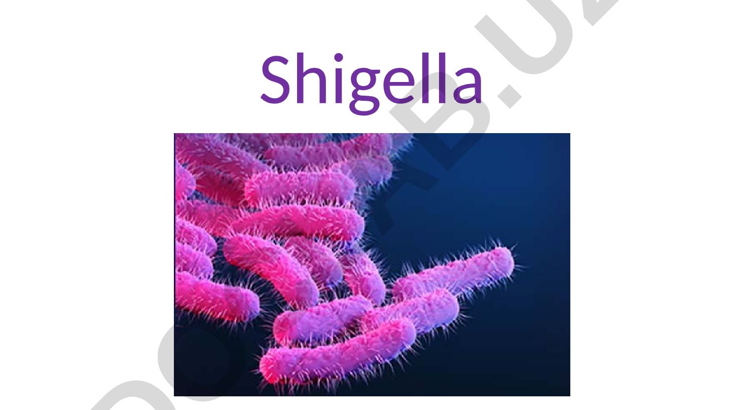 Shigella bakteriyalari va shigelloz kasalligi
