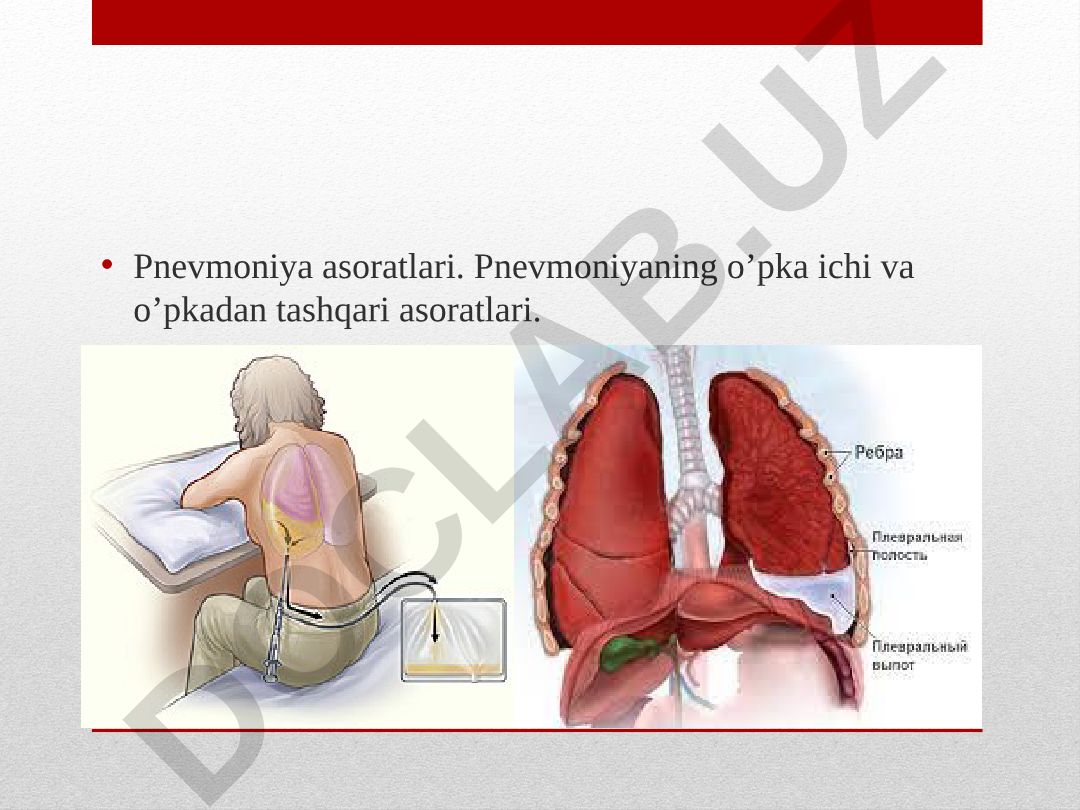 Pnevmoniyaning asoratlari