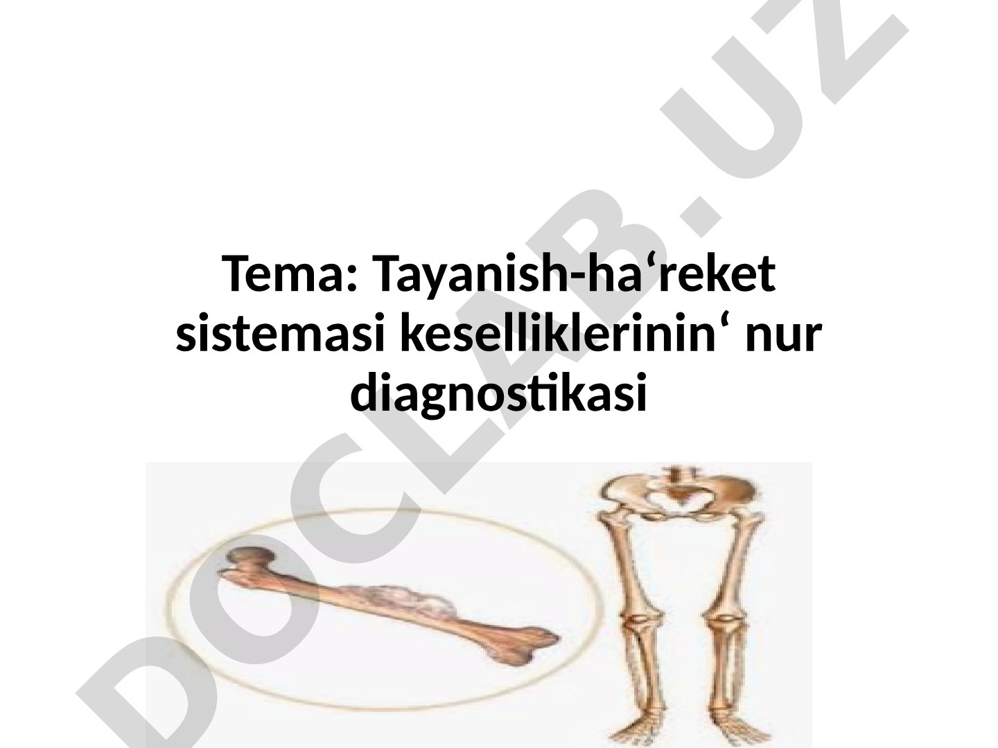 Tayanish-ha‘reket sistemasi keselliklerinin‘ nur diagnostikasi