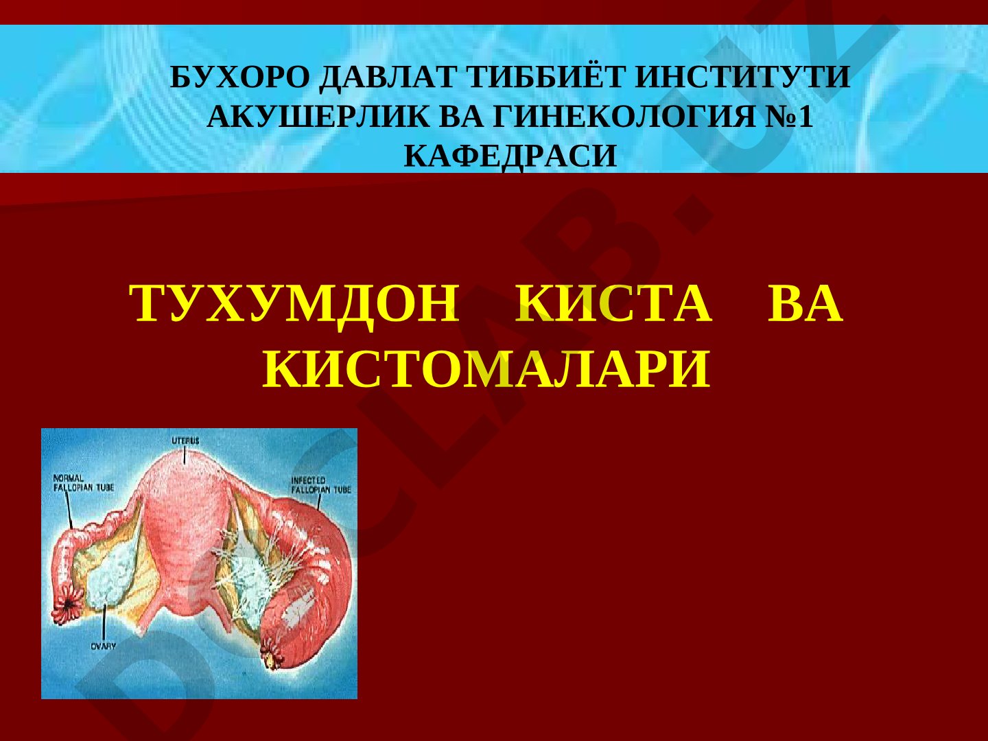 Тухумдон киста ва кистомалари