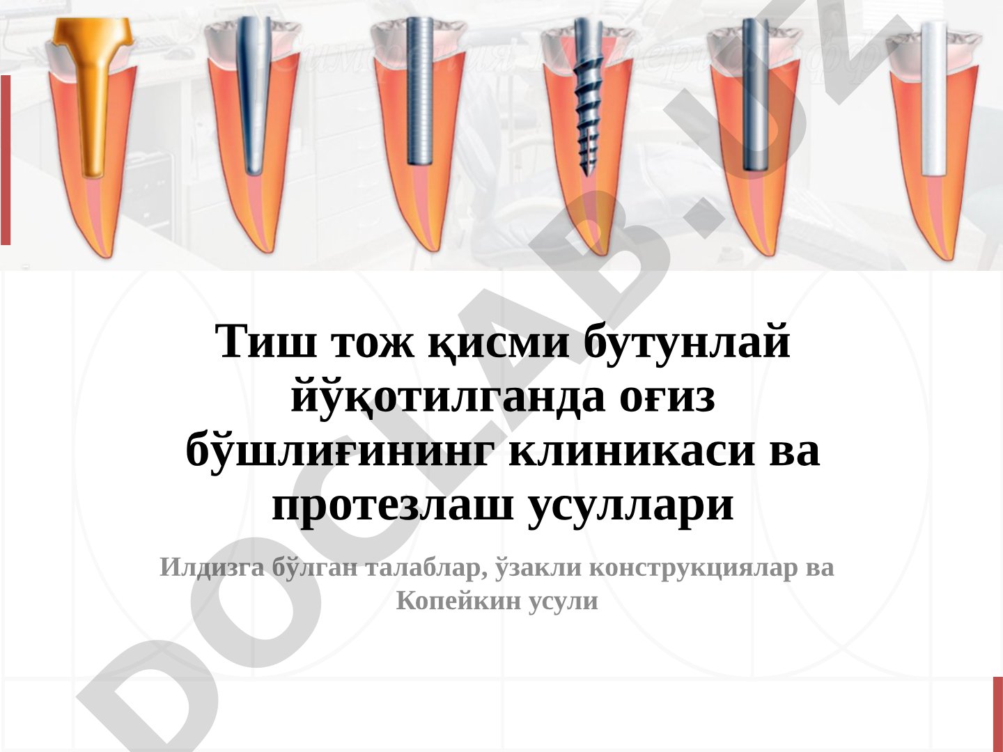 Тиш тож қисми бутунлай йўқотилганда оғиз бўшлиғининг клиникаси ва протезлаш усуллари