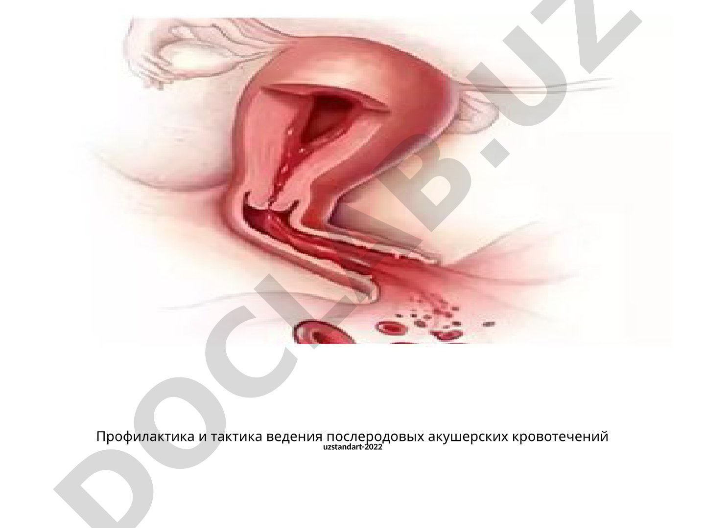 Профилактика и тактика ведения послеродовых акушерских кровотечений