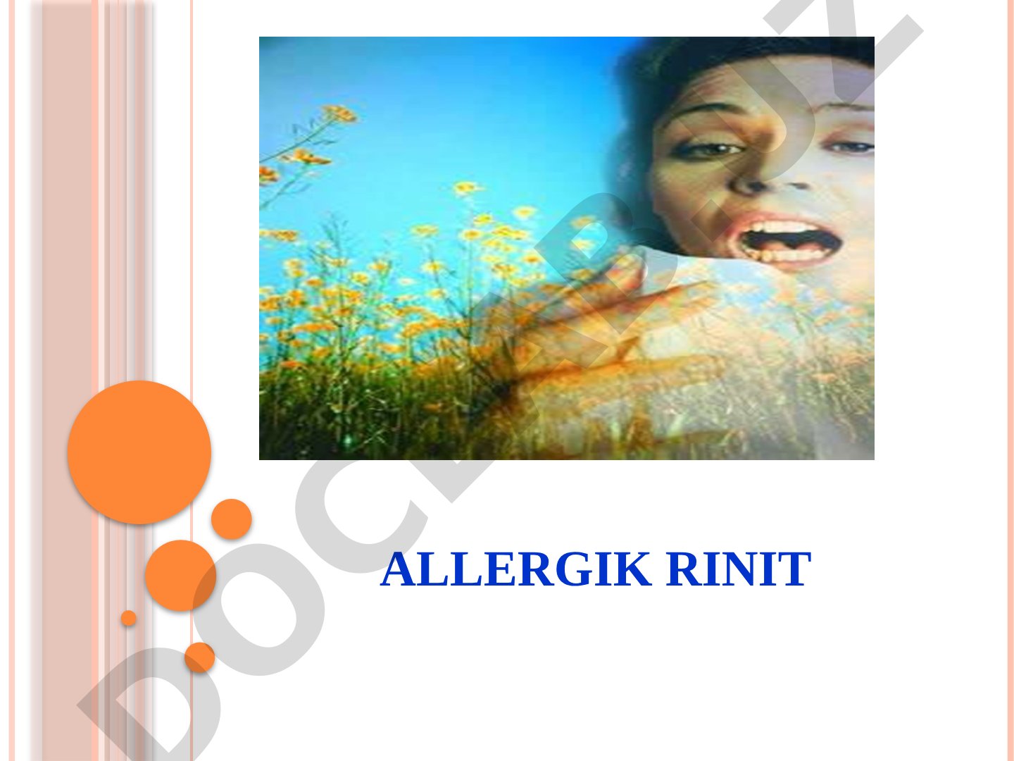 Allergik rinit