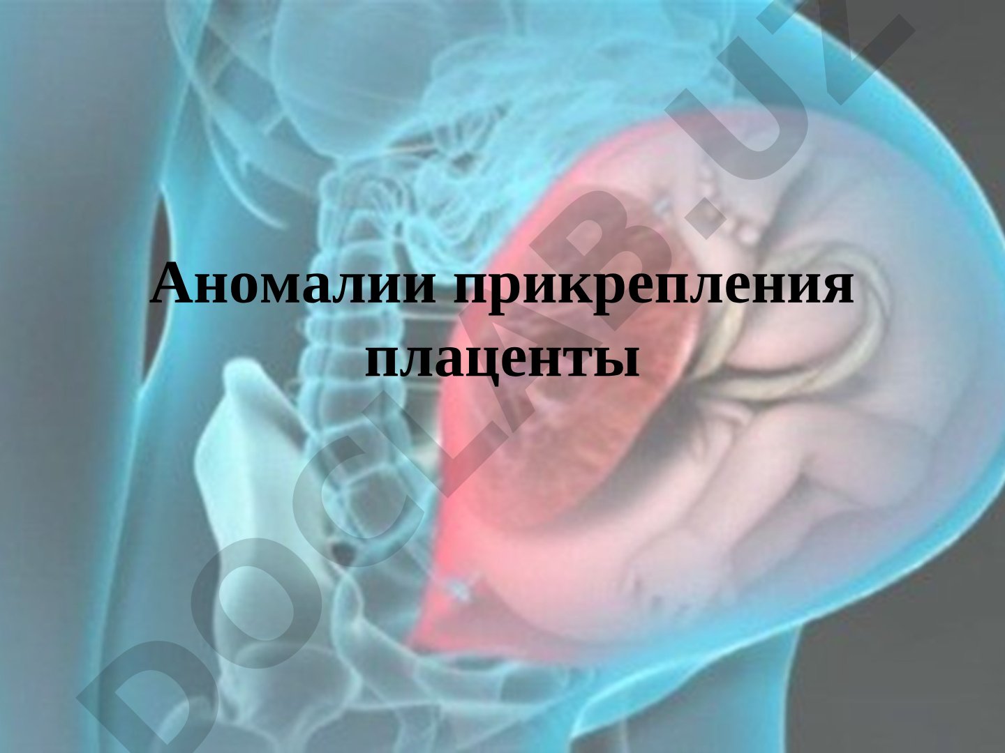Аномалии прикрепления плаценты