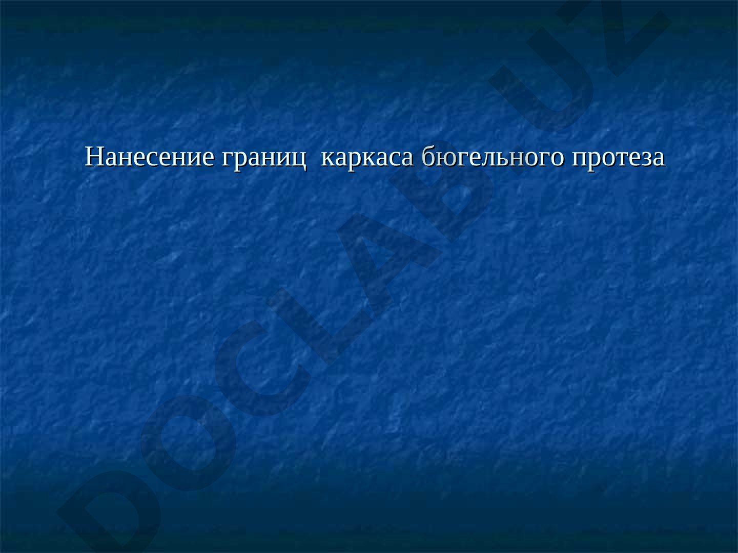 Нанесение границ каркаса бюгельного протеза