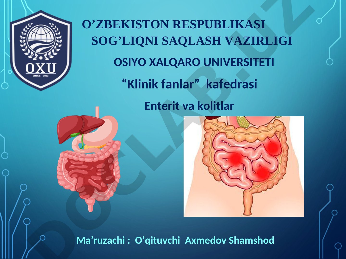 Ingichka va yo'g'on ichak yallig'lanishi, surunkali enterit etiologiyasi va tasnifi