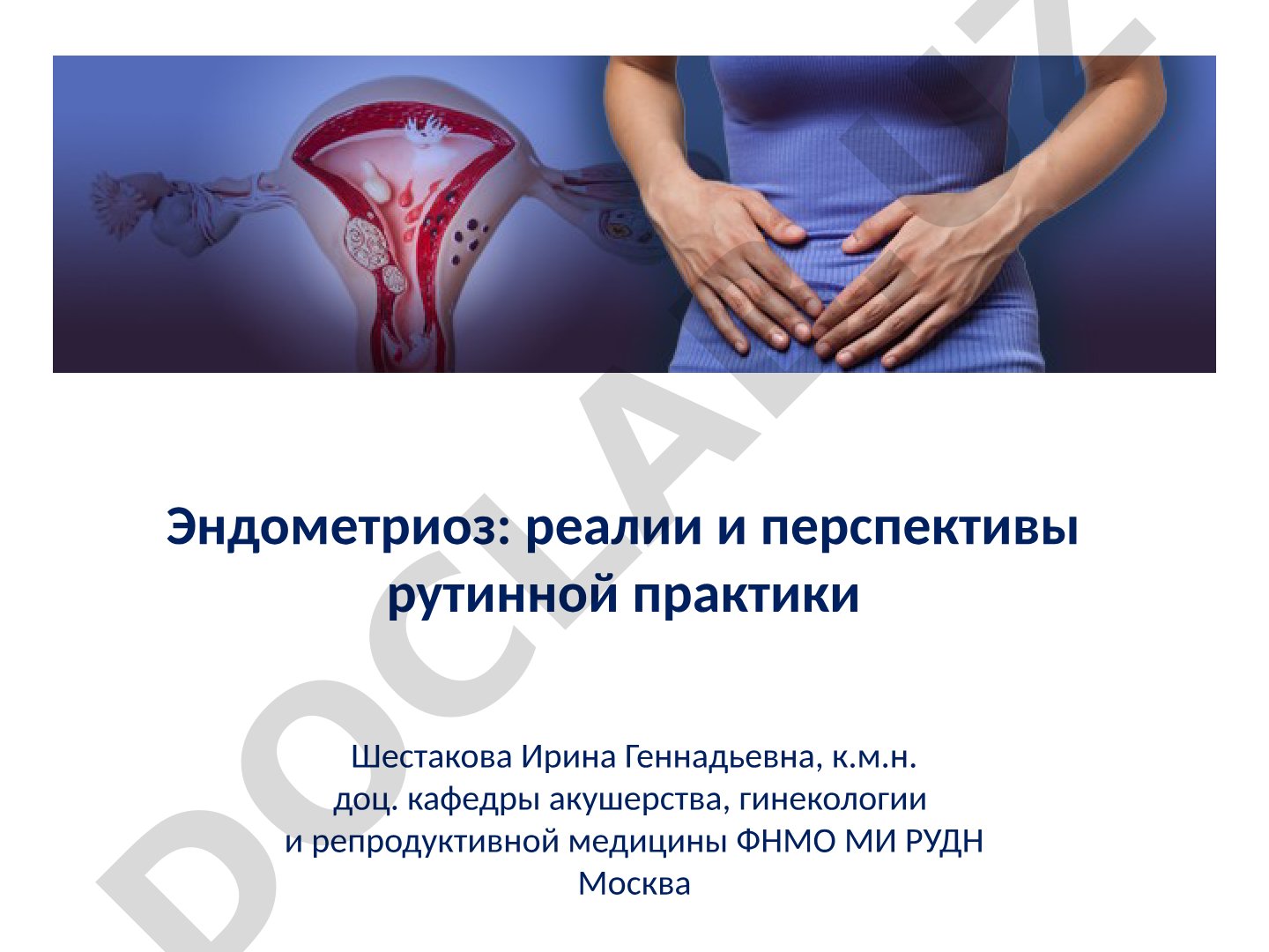 Эндометриоз: реалии и перспективы рутинной практики
