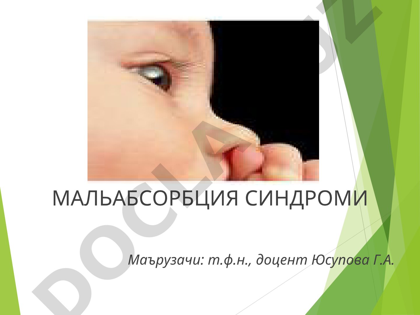 МАЛЬАБСОРБЦИЯ СИНДРОМИ