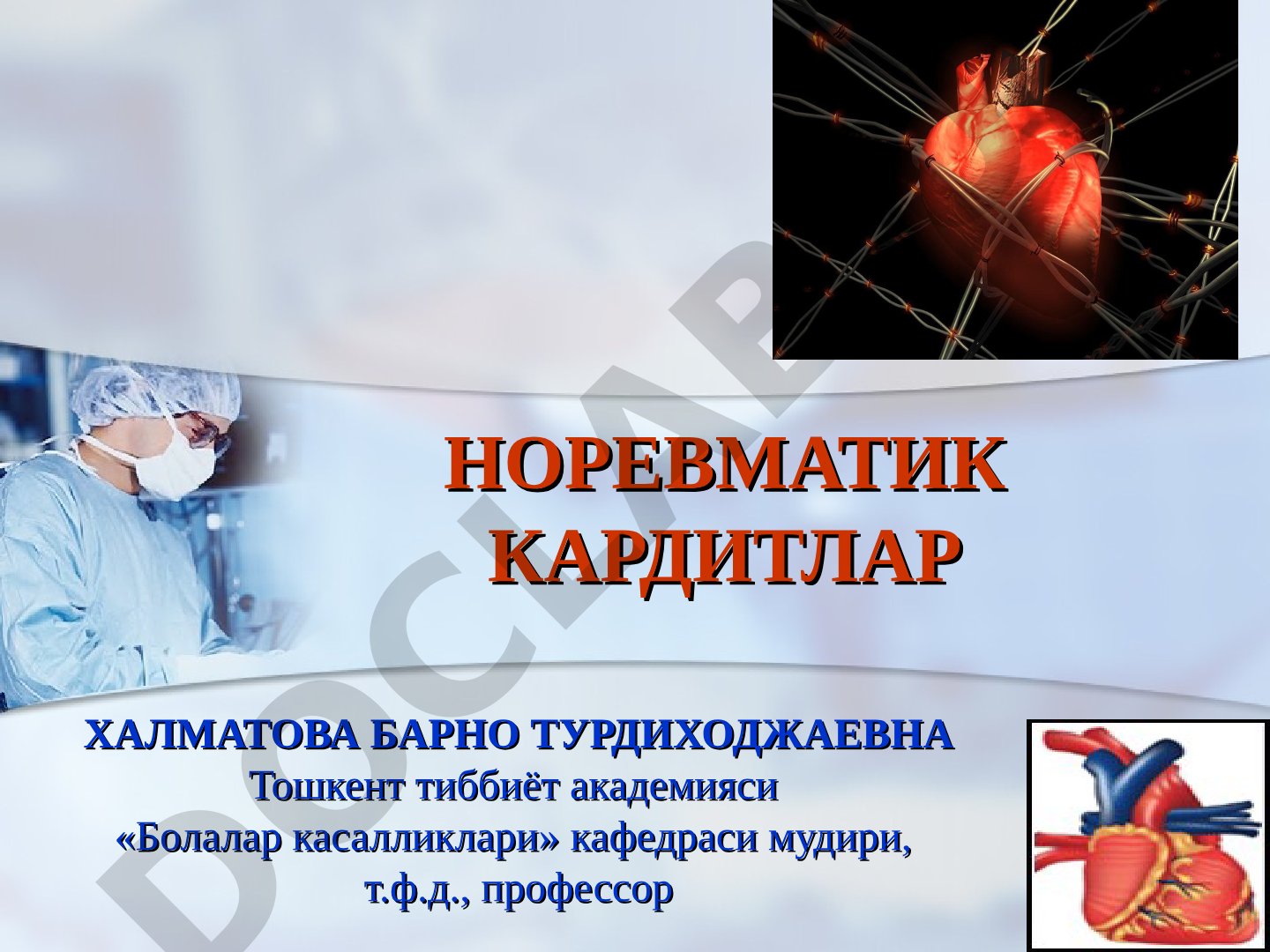 Норевматик кардитлар ва кардиомегалия