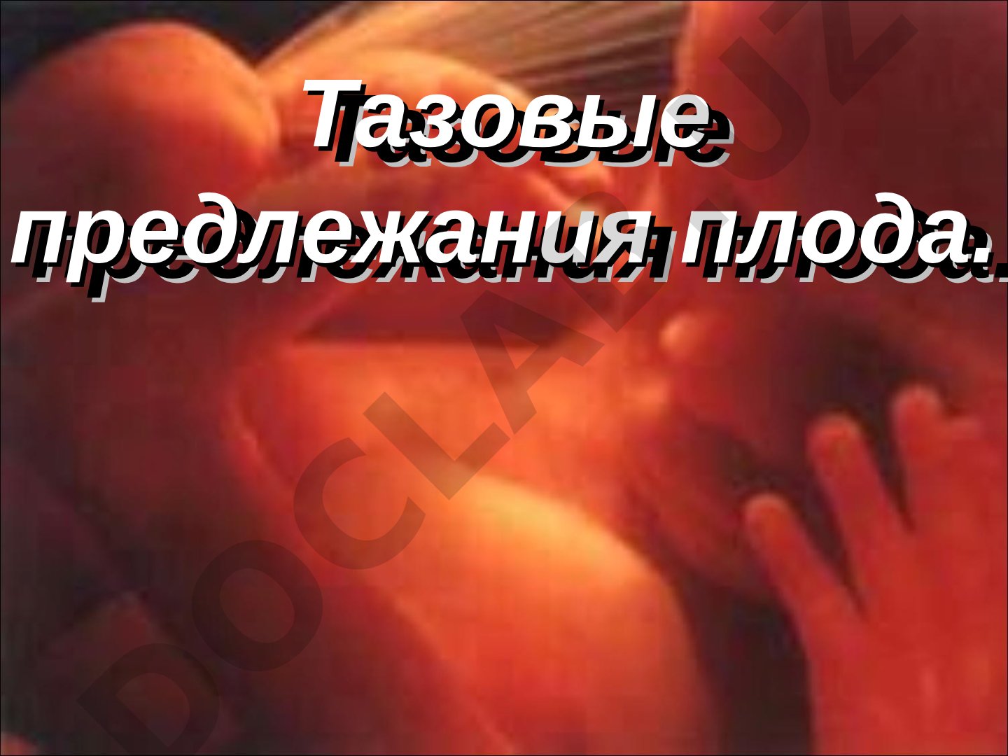 Этиология, диагностика и биомеханизм родов при тазовых предлежаниях плода