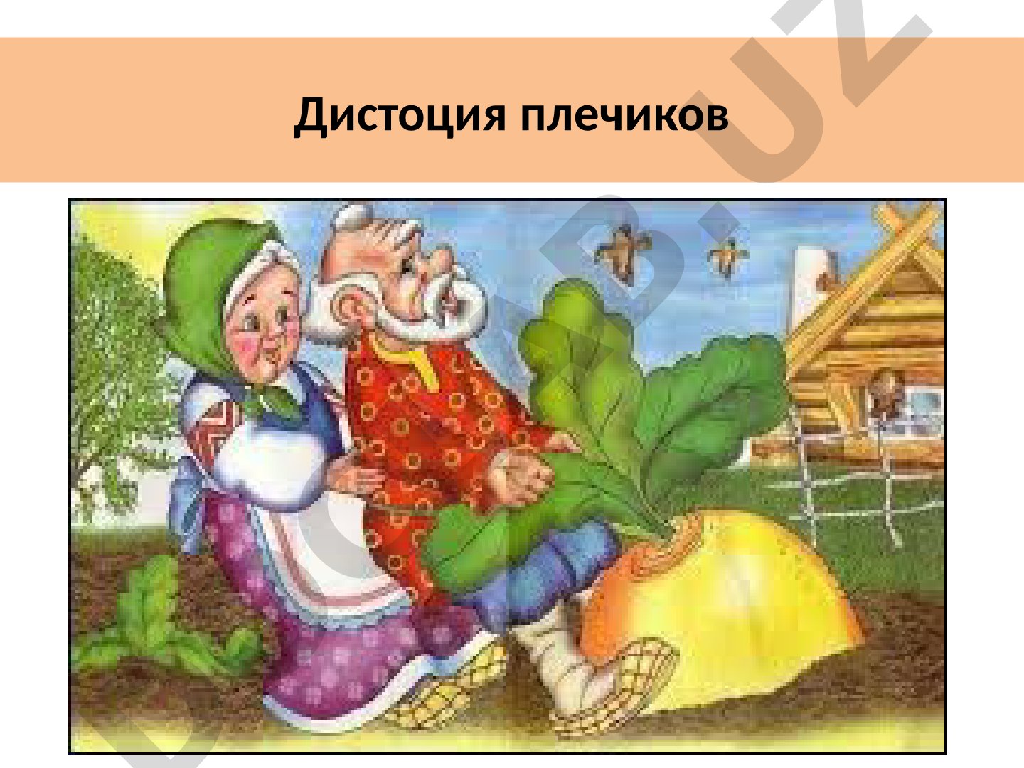 Дистоция плечиков