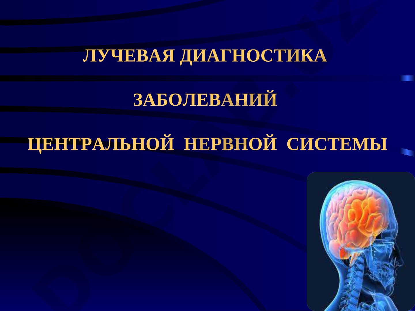 Лучевая диагностика заболеваний центральной нервной системы