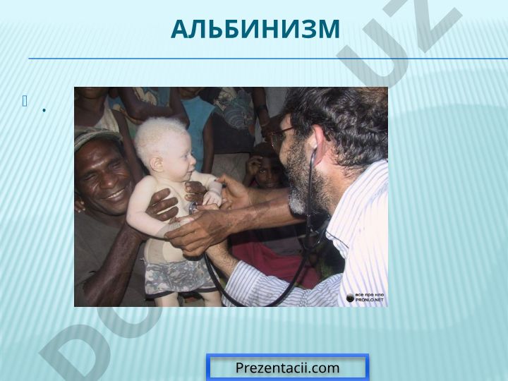 Альбинизм: причины, типы и характеристики