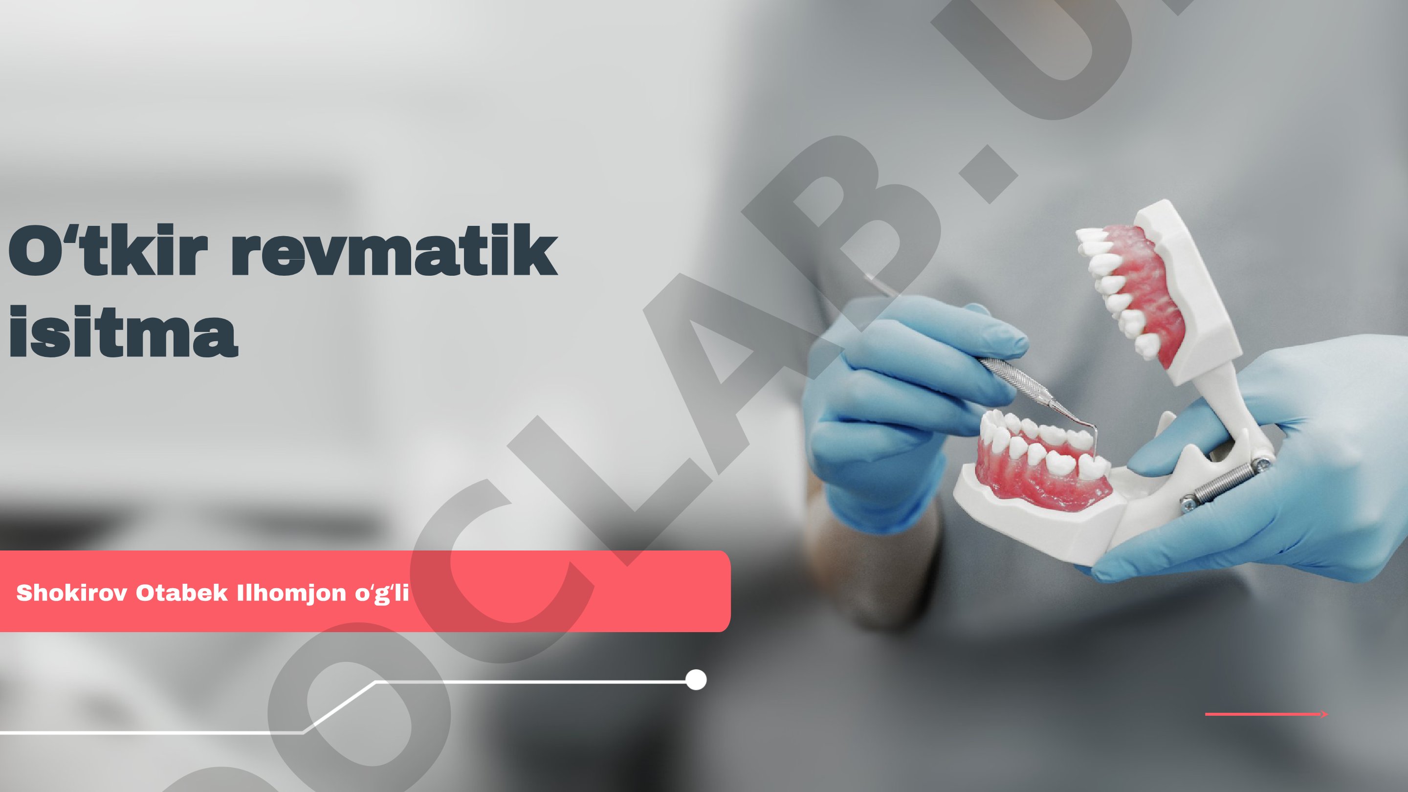 Oʻtkir revmatik isitma