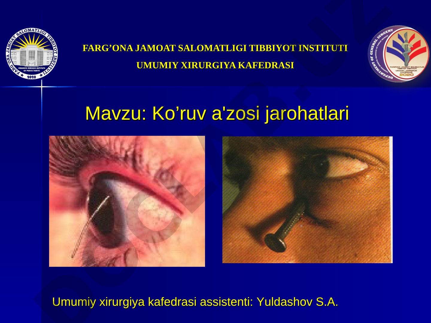 Ko'ruv a'zosi jarohatlari