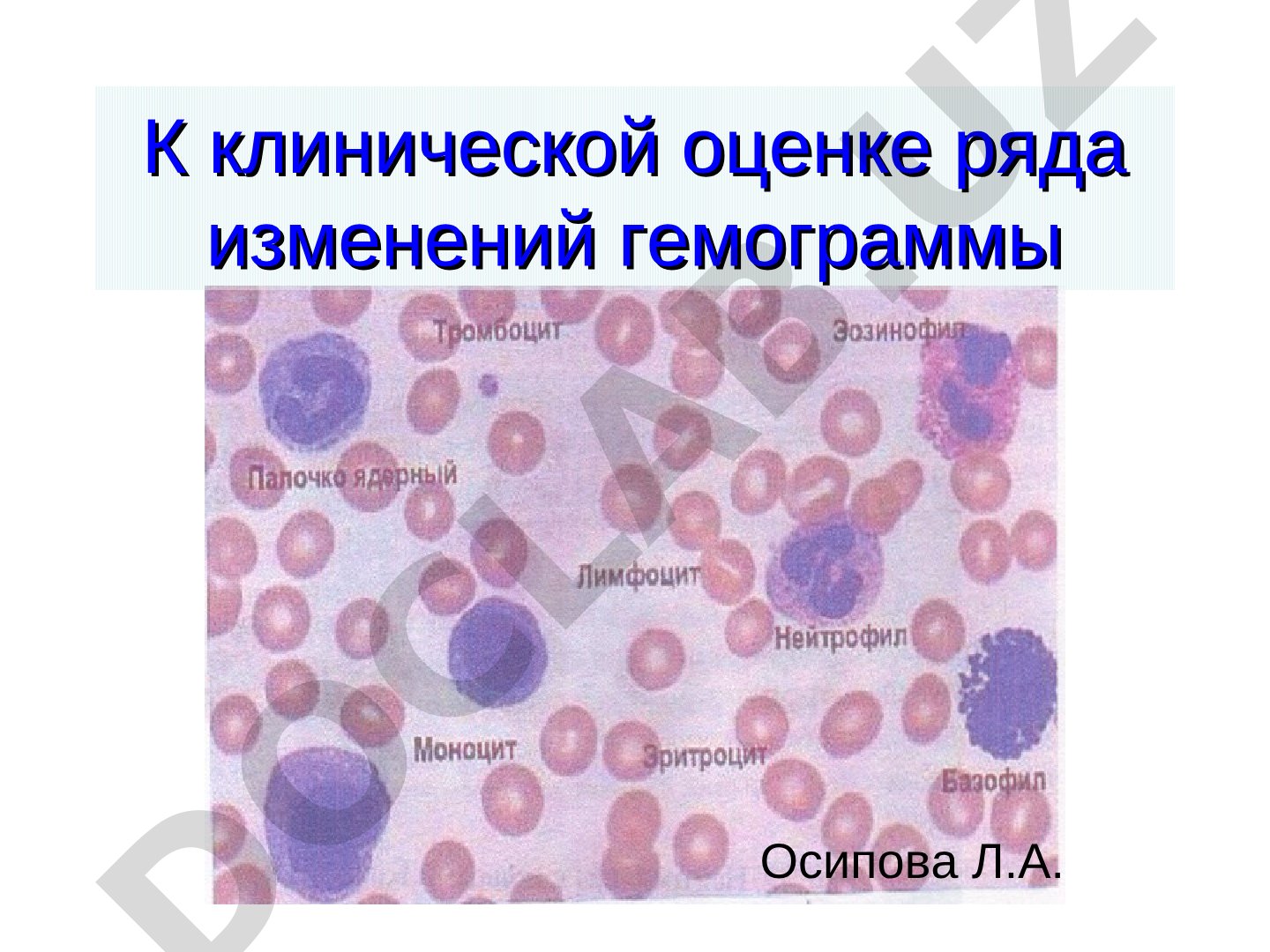 К клинической оценке ряда изменений гемограммы