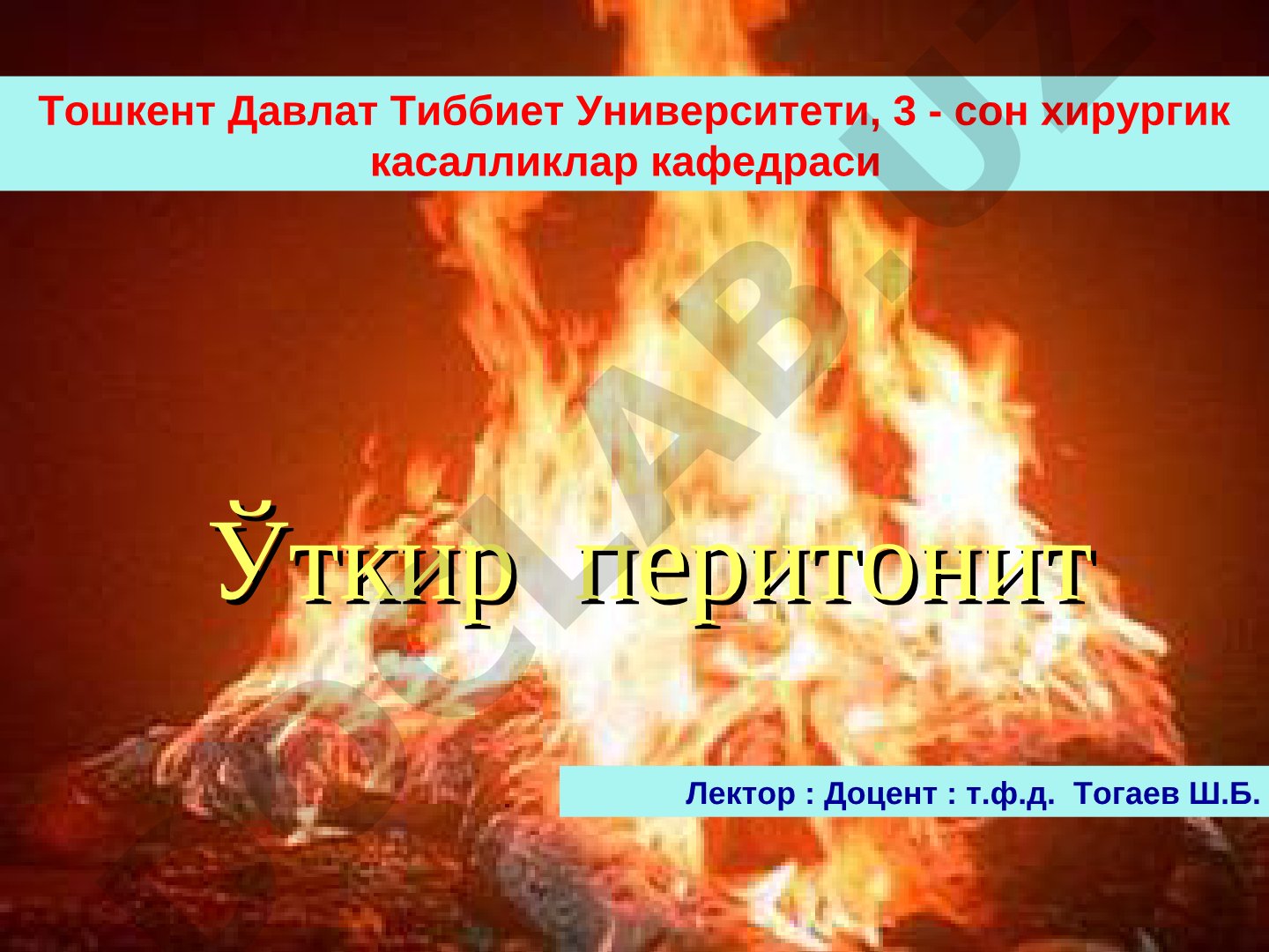 Ўткир перитонит