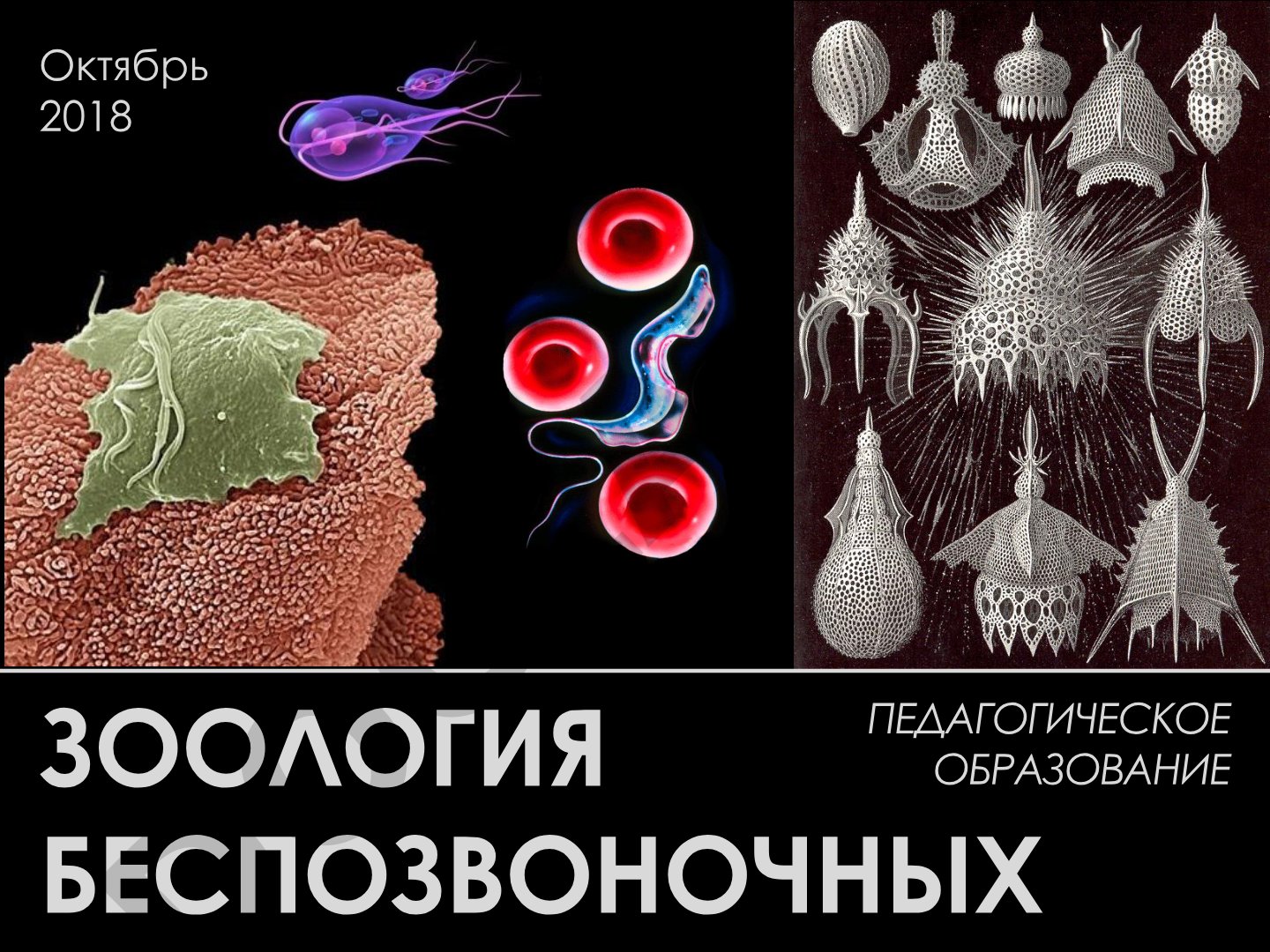 Зоология беспозвоночных: Тип Sarcomastigophora