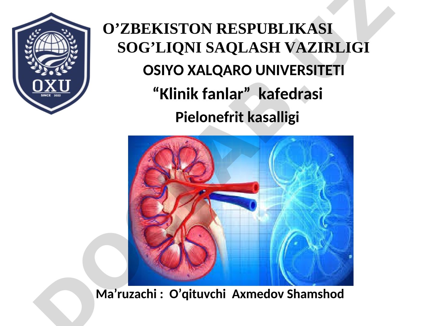 Buyraklarning yallig'lanish kasalligi pielonefrit: etiologiyasi, patogenezi, tasnifi