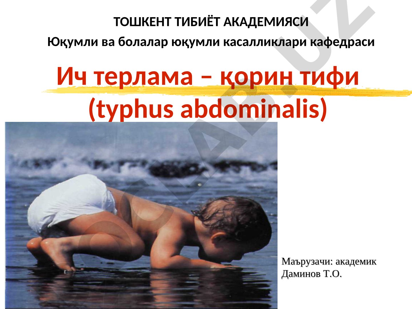 Ич терлама – қорин тифи (typhus abdominalis)