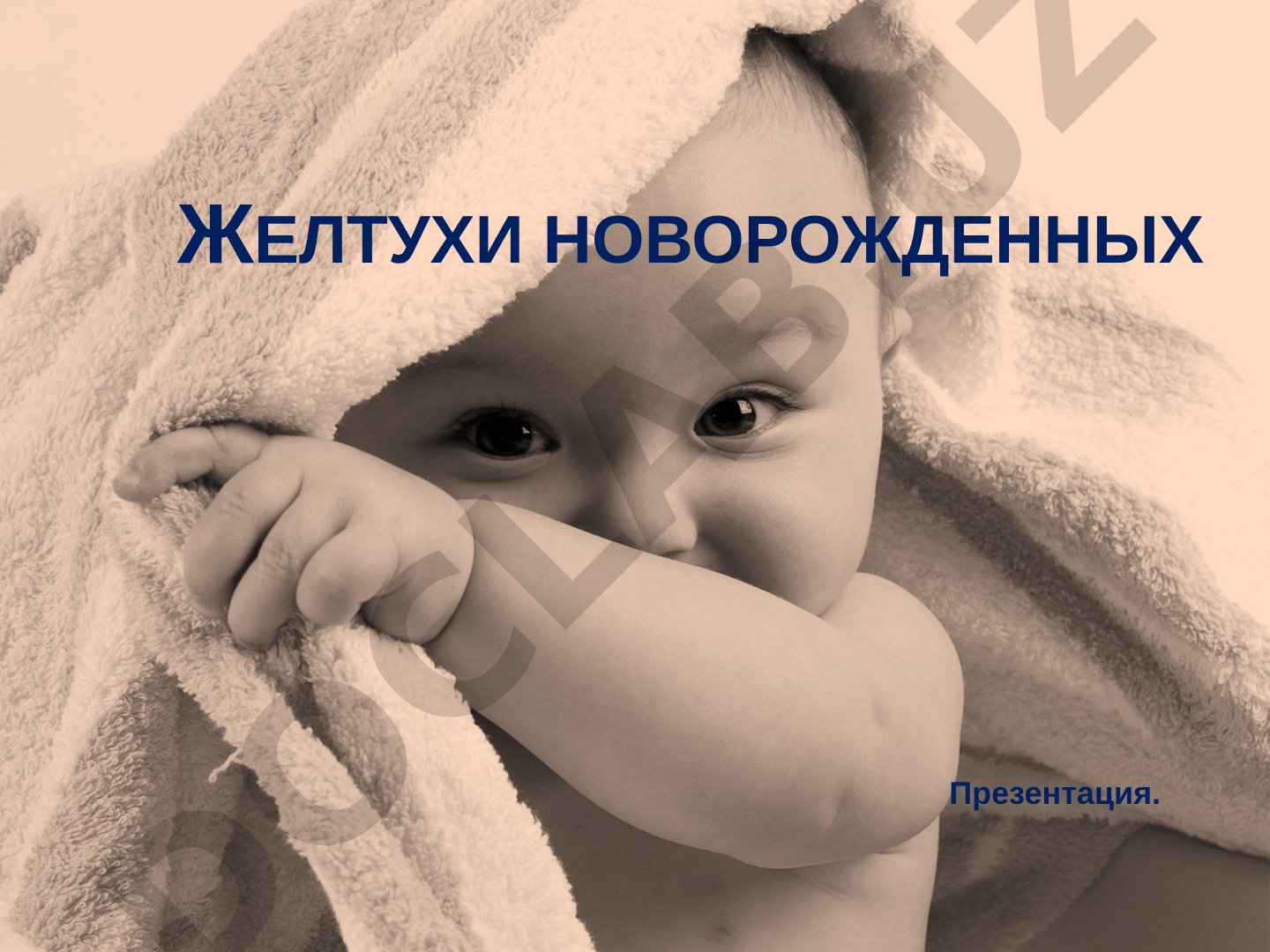 Желтуха новорожденного