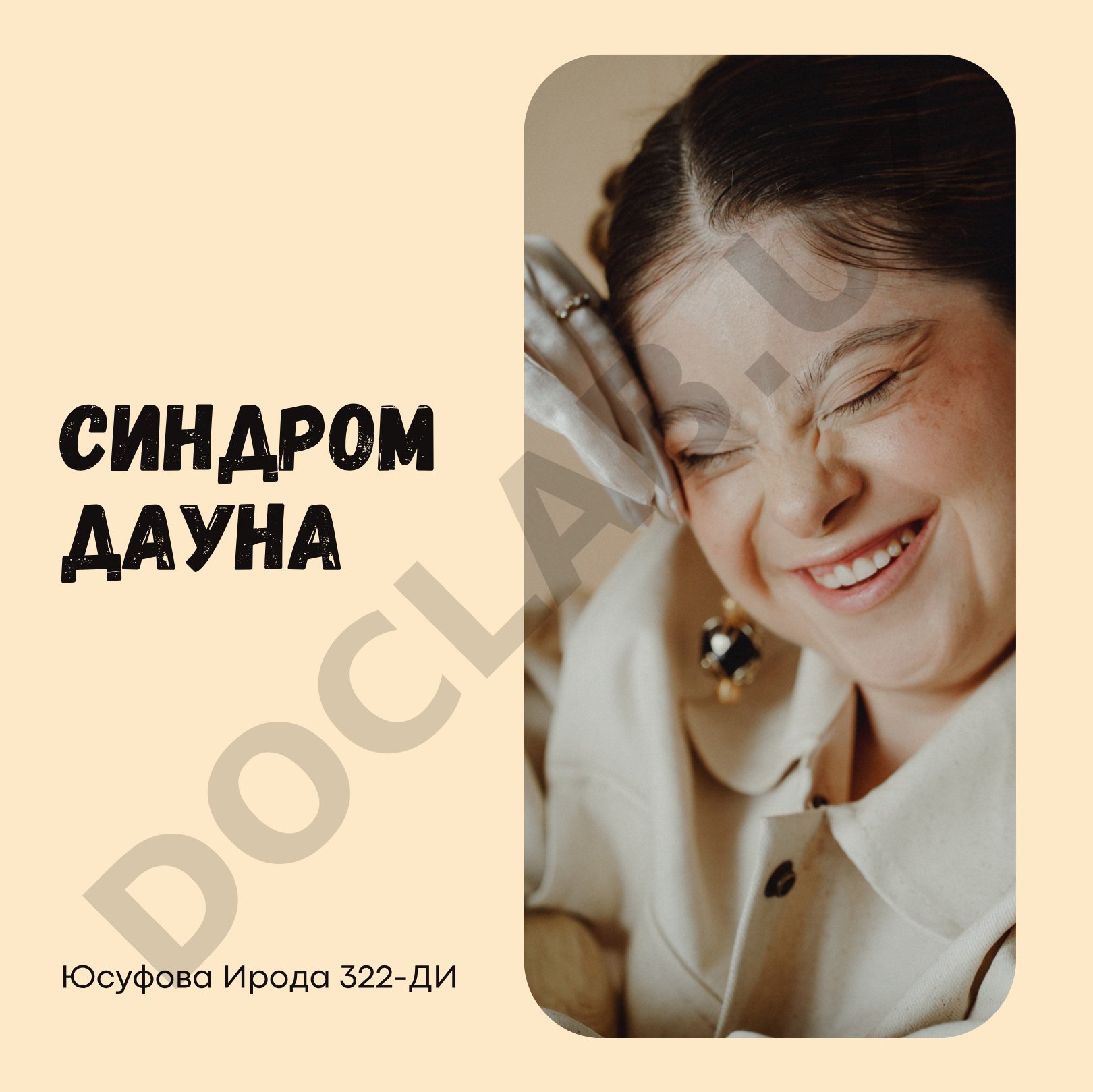 Синдром Дауна: хромосомная патология, причины, факторы риска