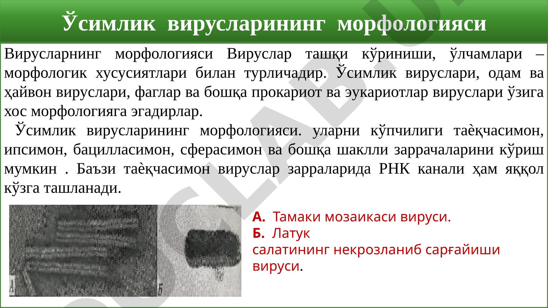 Вирусларнинг морфологияси: ўсимлик, фаг, одам ва ҳайвон вируслари тузилиши