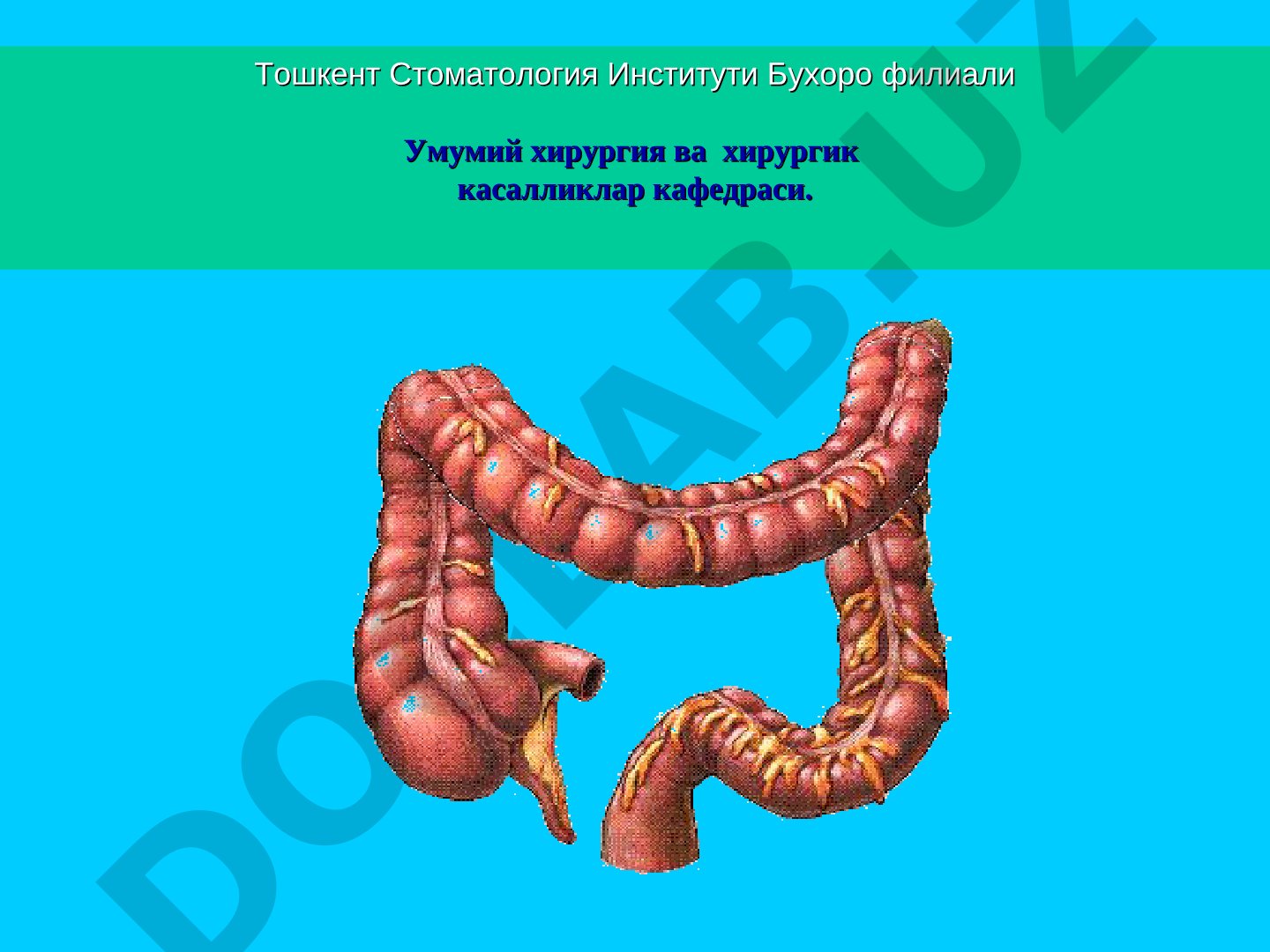 Ўткир ичак тутилиши