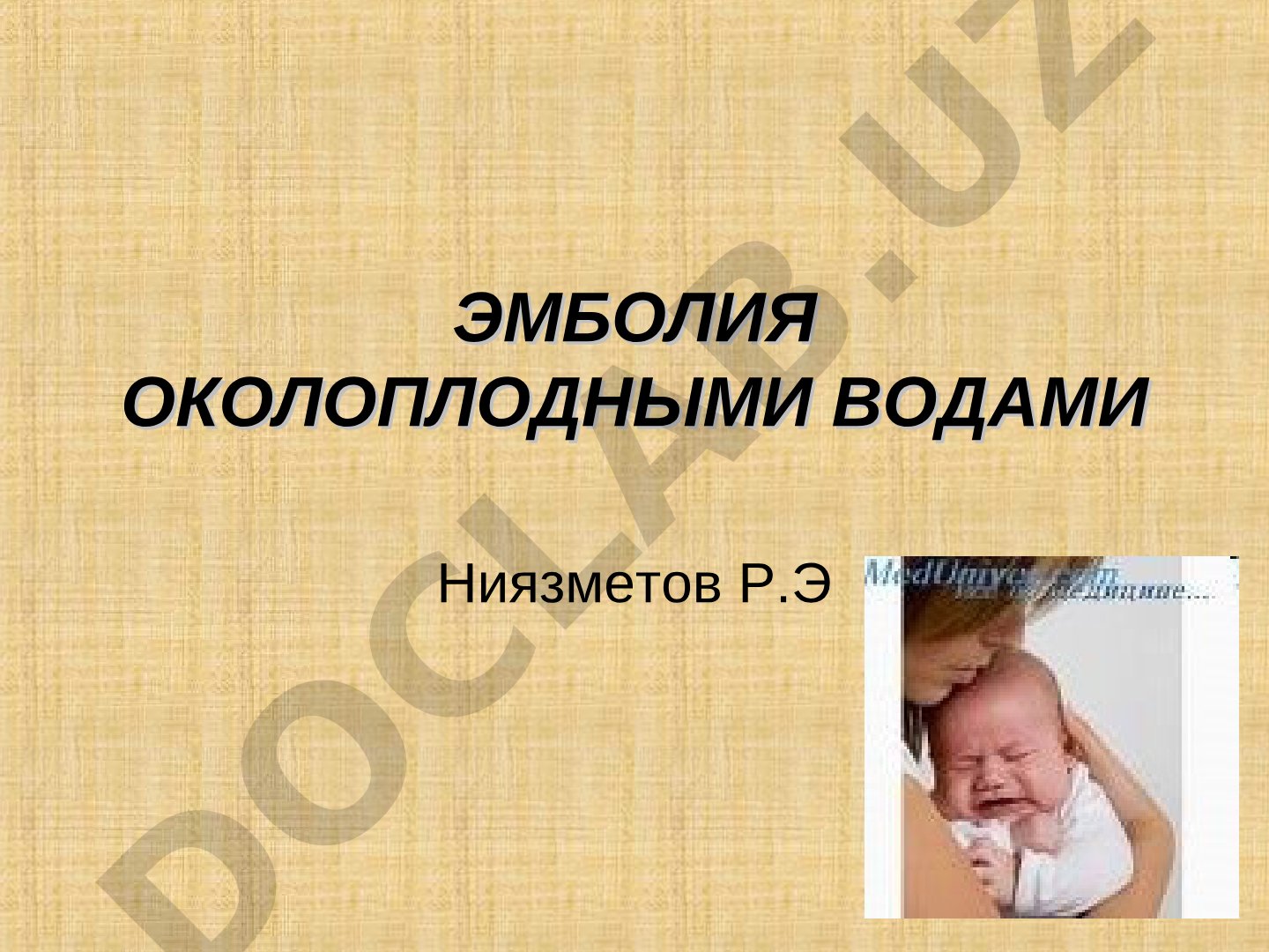 Эмболия околоплодными водами