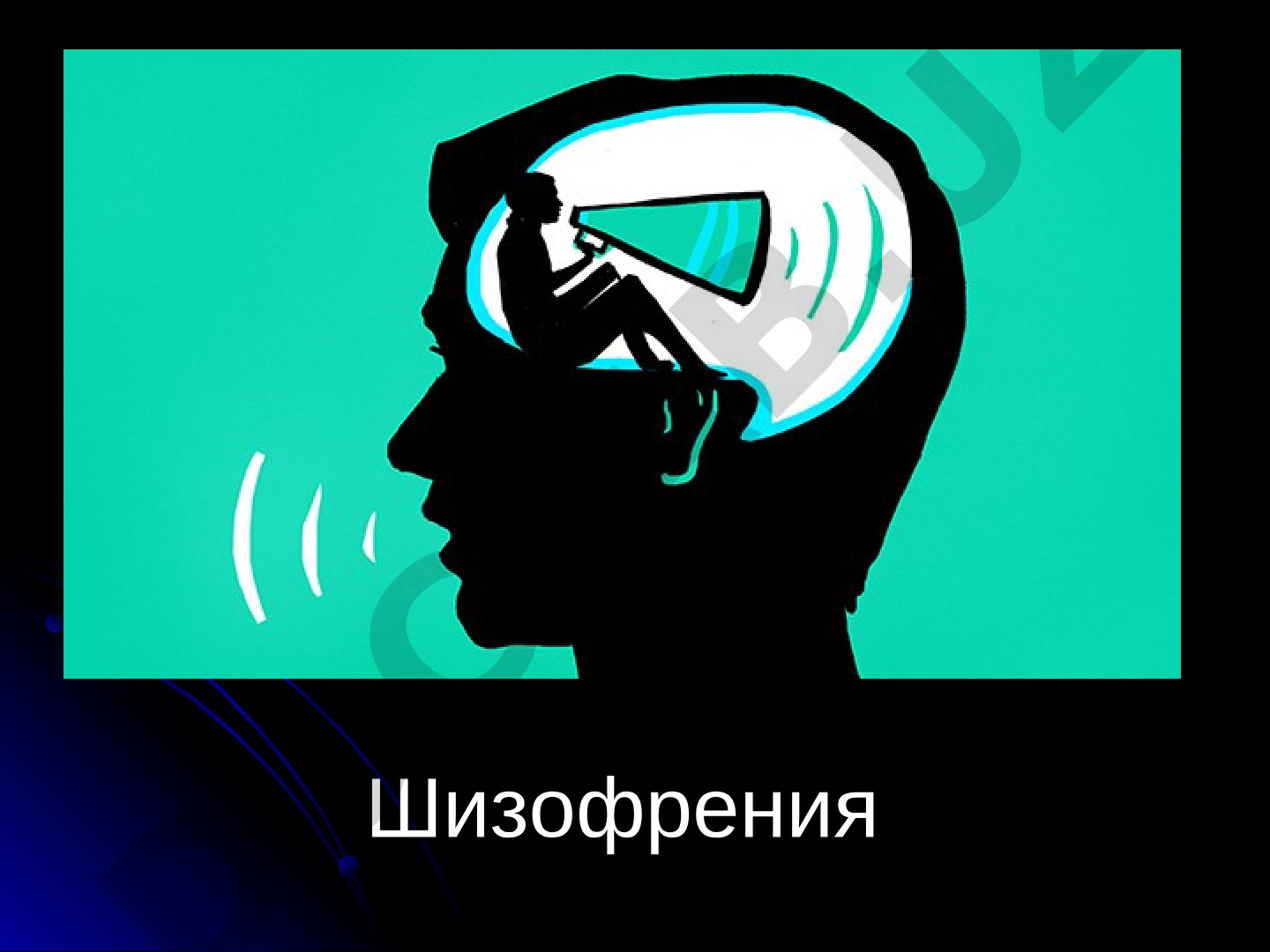 Шизофрения эпидемиологияси ва клиник кўринишлари
