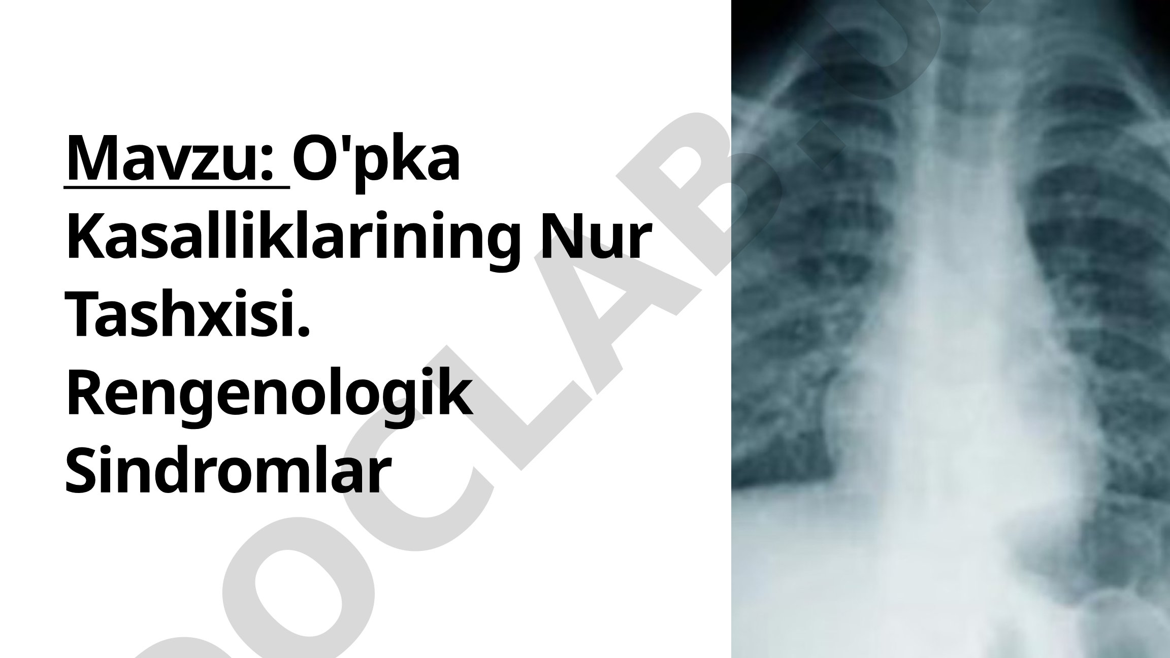 O'pka Kasalliklarining Nur Tashxisi. Rengenologik Sindromlar 1