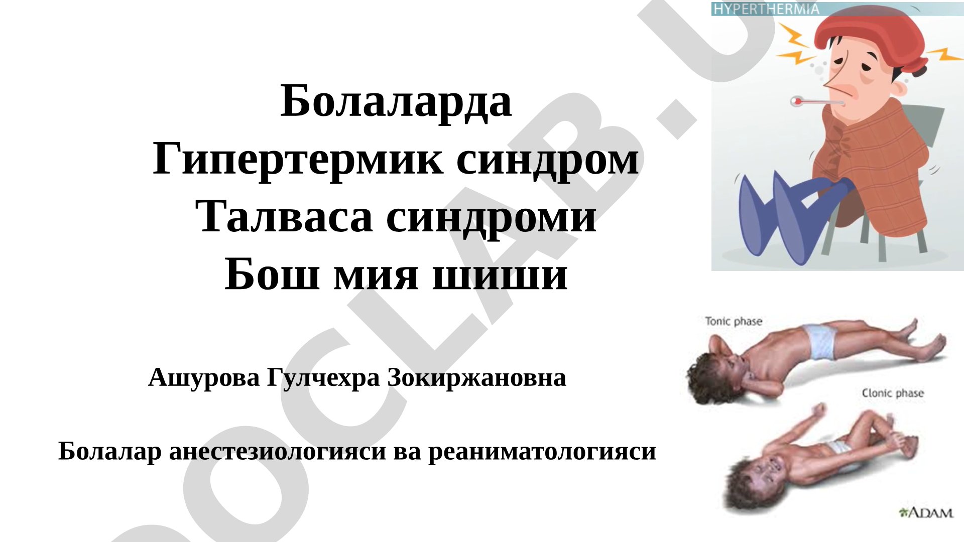 Болаларда Гипертермик синдром Талваса синдроми Бош мия шиши
