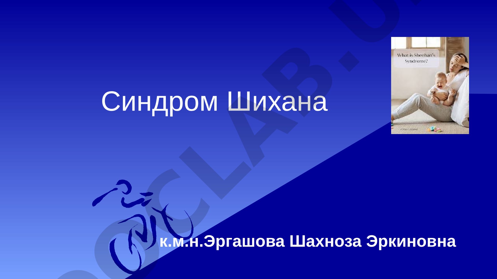 Синдром Шихана (послеродовой гипопитуитаризм)