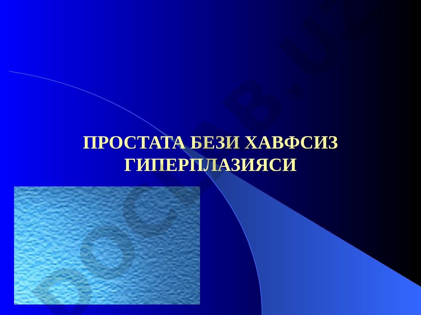 Простата бези хавфсиз гиперплазияси