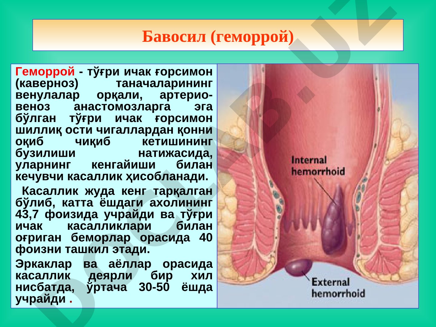Геморрой - тўғри ичак ғорсимон таначаларининг кенгайиши