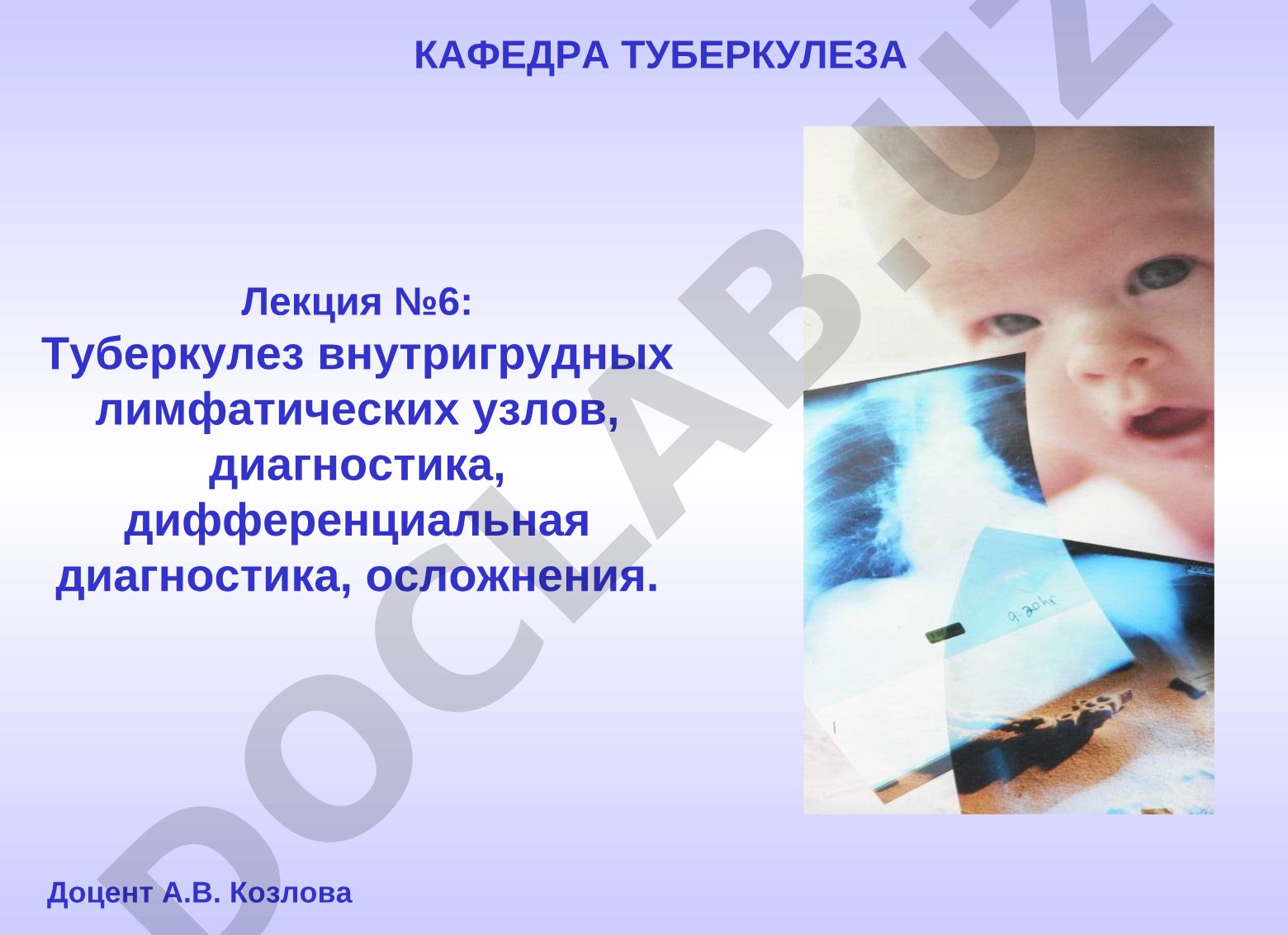 Туберкулез внутригрудных лимфатических узлов, диагностика, дифференциальная диагностика, осложнения