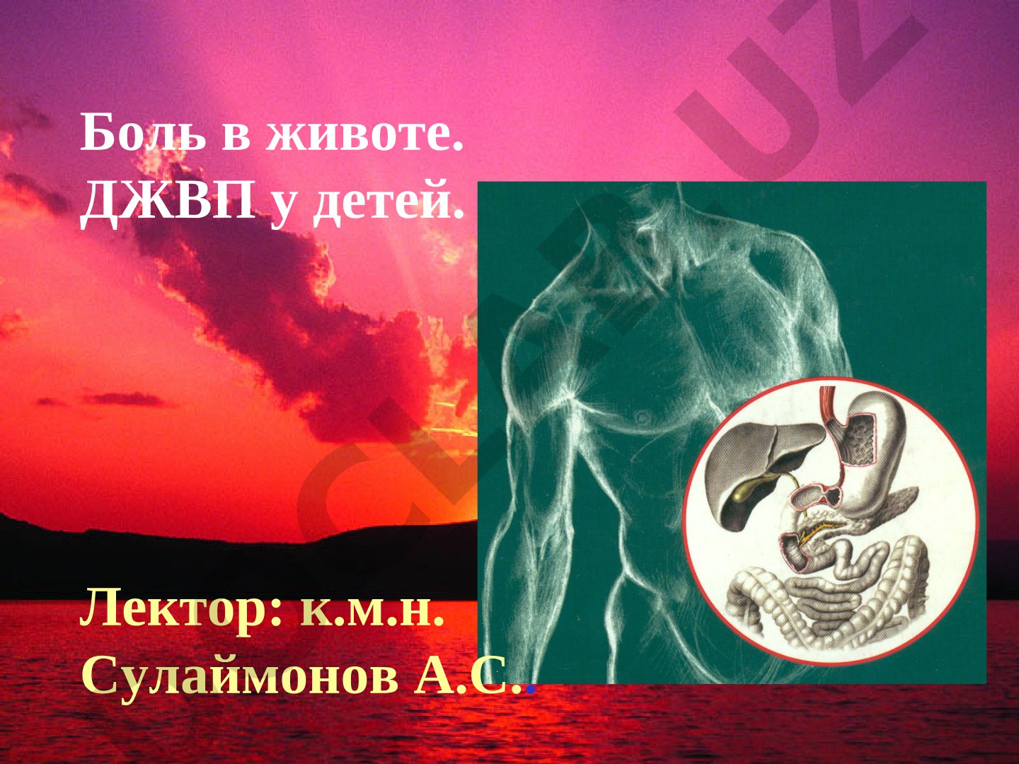 Боль в животе. ДЖВП у детей.