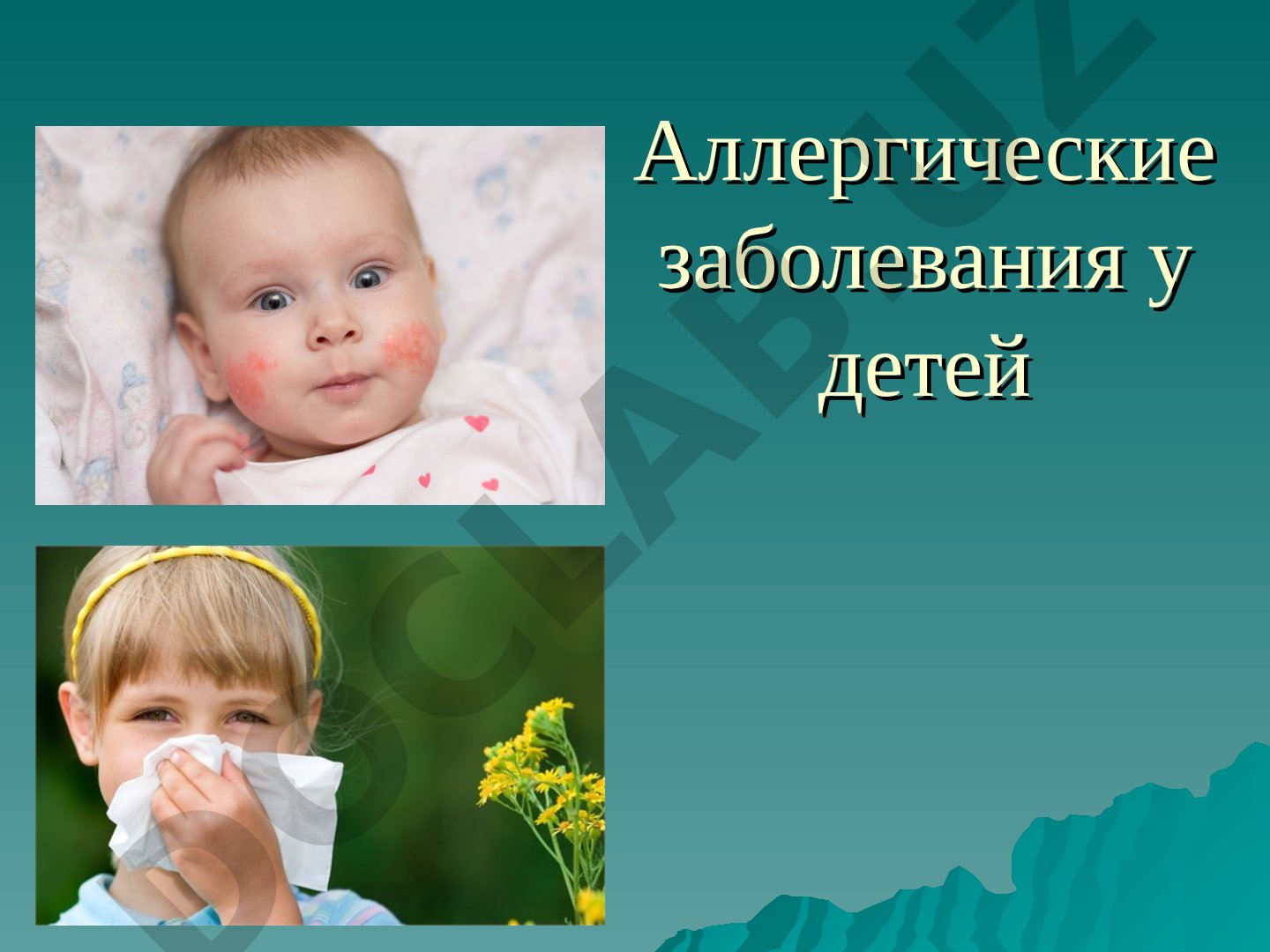 Аллергические заболевания у детей