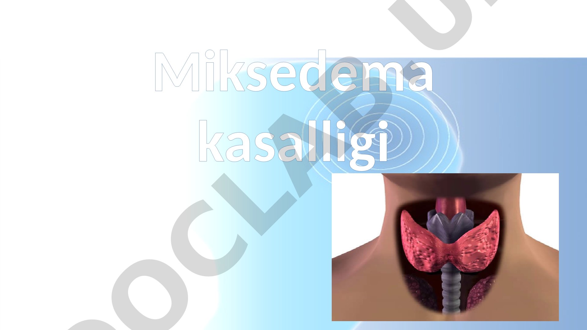 Miksedema kasalligi