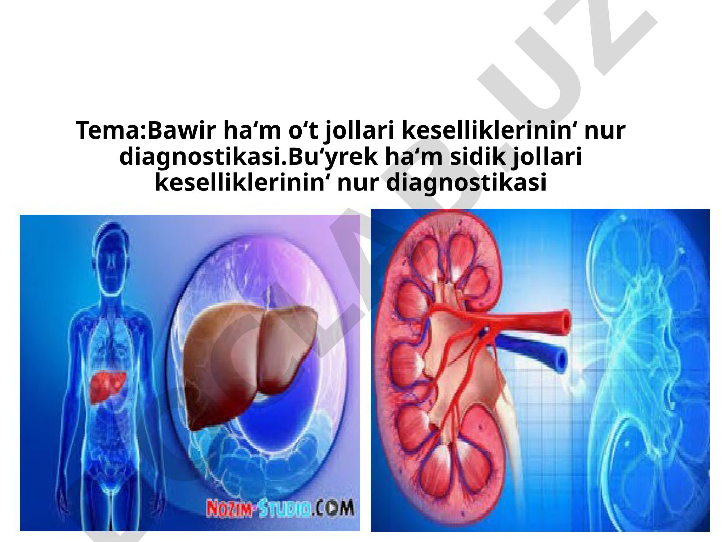 Bawir ha‘m o‘t jollari keselliklerinin‘ nur diagnostikasi. Bu‘yrek ha‘m sidik jollari keselliklerinin‘ nur diagnostikasi
