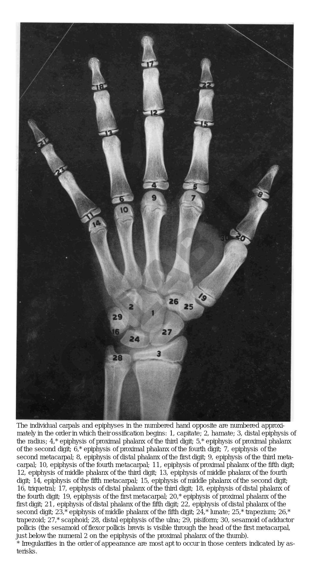 Ossification order of hand bones