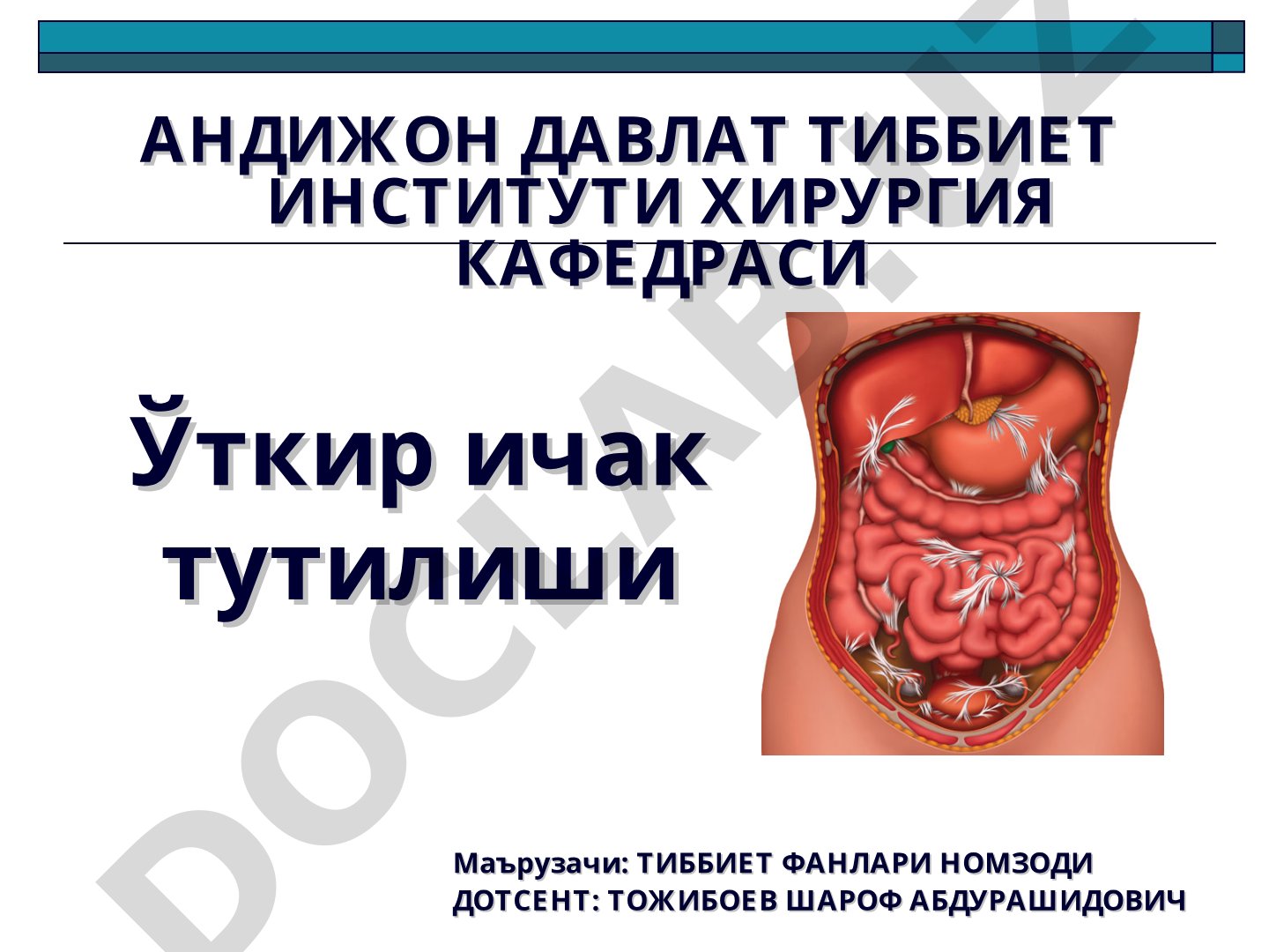 Ўткир ичак тутилиши