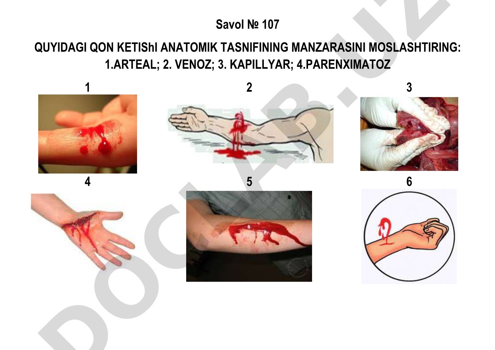 Qon ketishi anatomik tasnifi