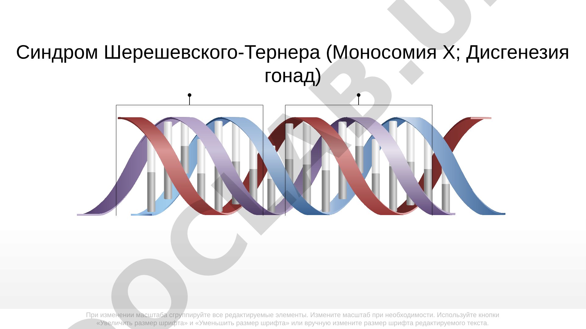 Синдром Шерешевского-Тернера (Моносомия Х; Дисгенезия гонад)
