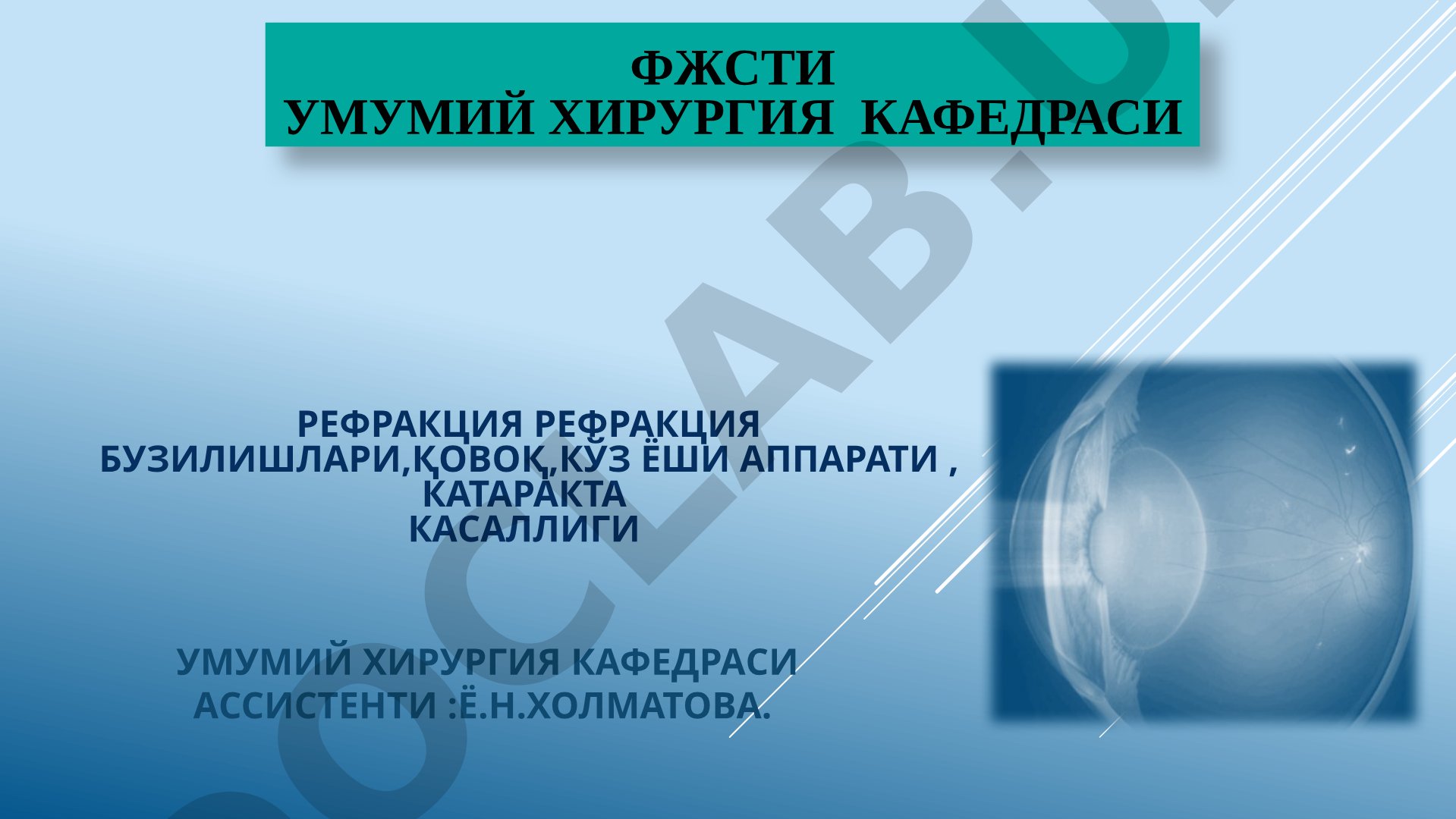 Рефракция бузилишлари, ковок, куз ёши аппарати, катаракта касаллиги